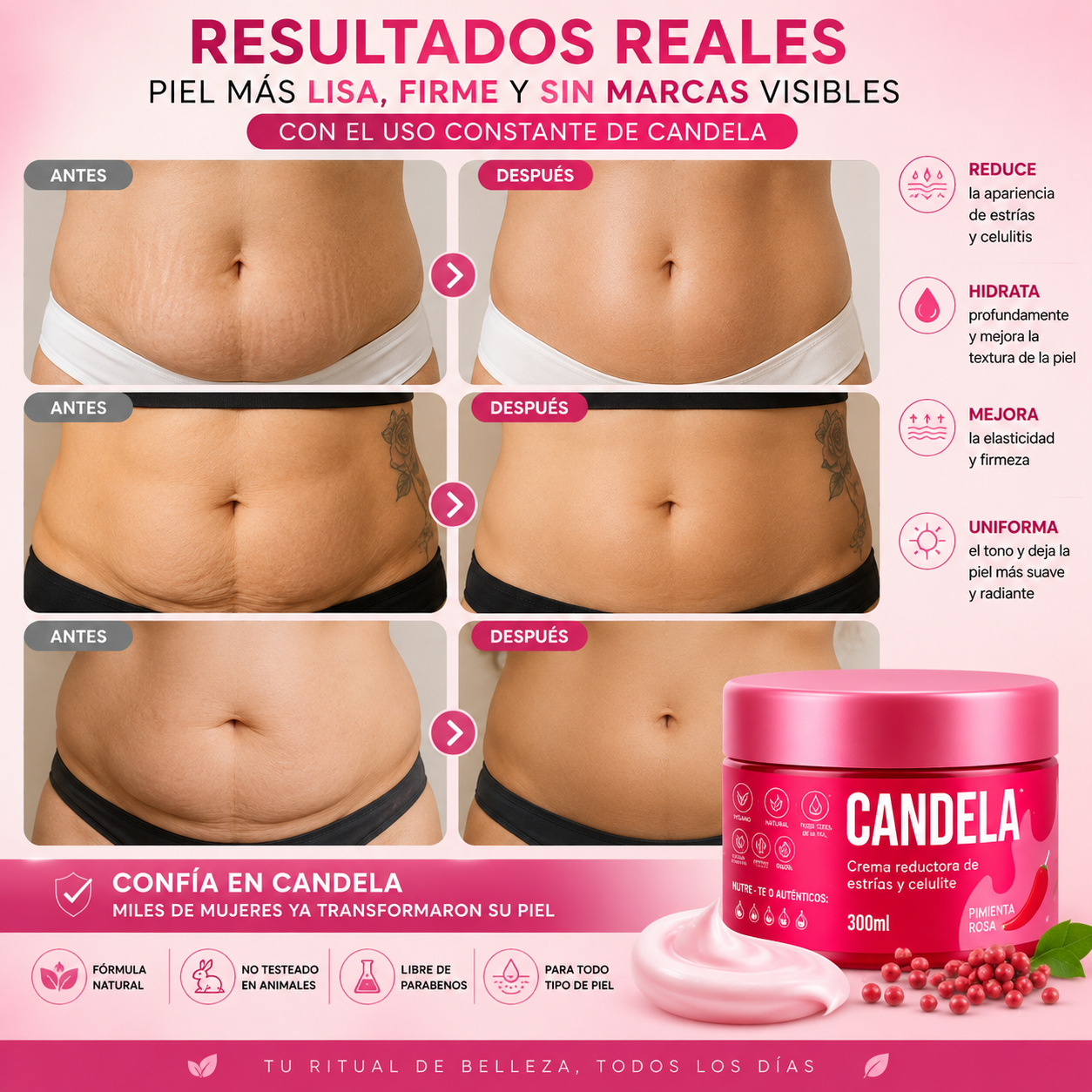 🌶️ CANDELA Crema Reductora Corporal 300 ml 🌸| Cuidado para Estrías, Celulitis y Firmeza 🔥