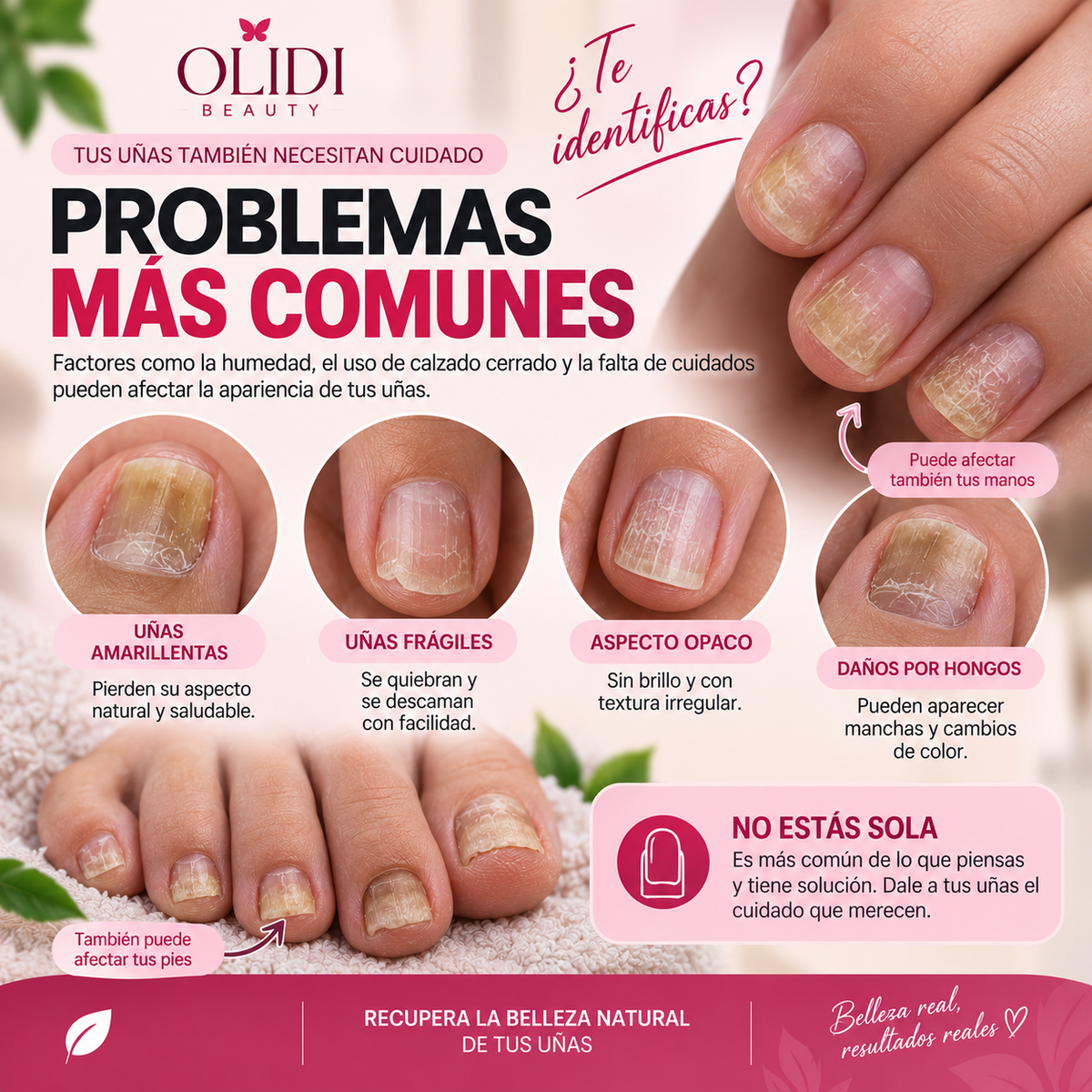 🍃🦶 Aceite Anti-Hongos para Uñas | Reparación Intensiva 30 ml • Resultados Visibles en 7 Días🔥