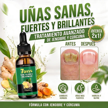 🍃🦶 Aceite Anti-Hongos para Uñas | Reparación Intensiva 30 ml • Resultados Visibles en 7 Días🔥